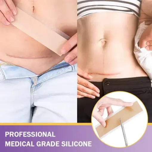 Hyaluronic Acid Nano Microneedle Repair Tape - Image 9