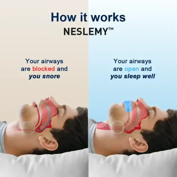 Professional Intelligent Anti-Snoring Device - Image 2