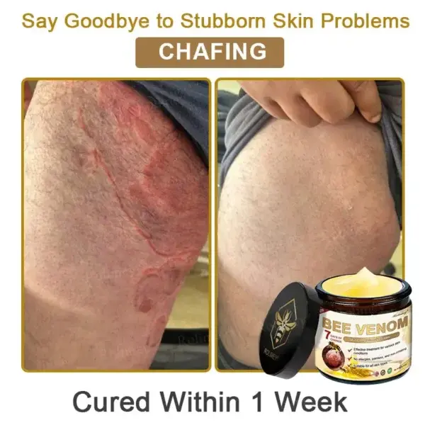 Botox Bee Venom Skin Treatment Cream - Image 8