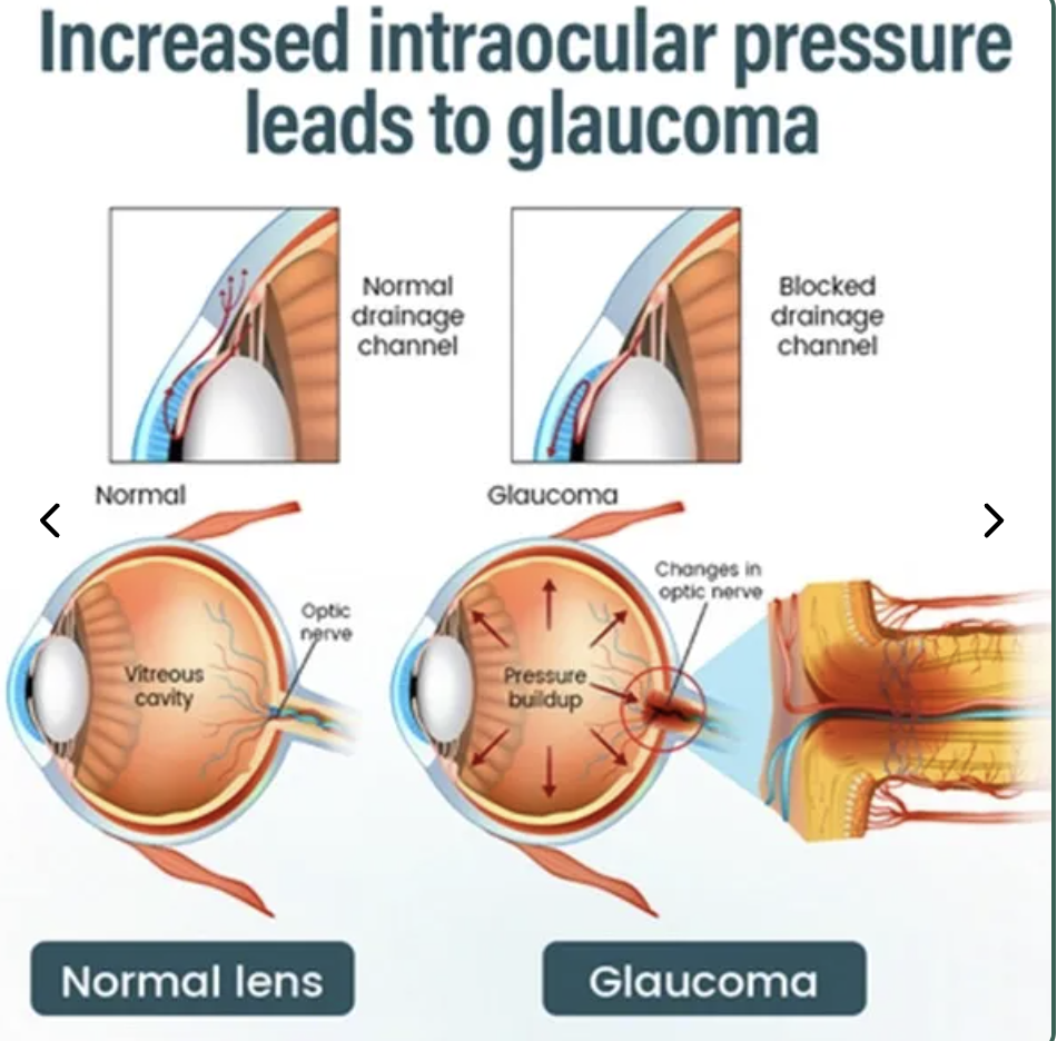 NANO Eye Drops - Image 3