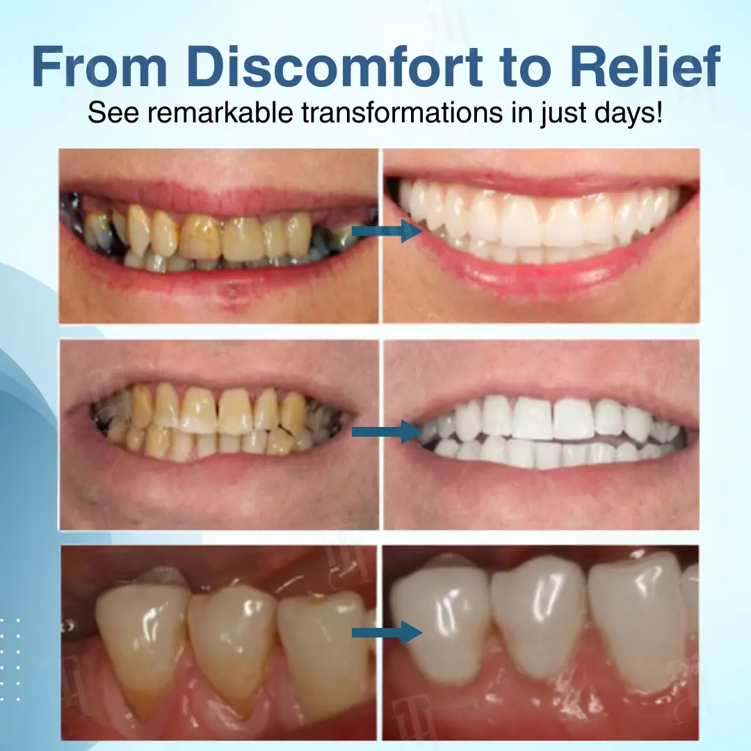 The Non-Surgical Way to Save Your Teeth: Dental Pulp Repair & Regeneration. - Image 2