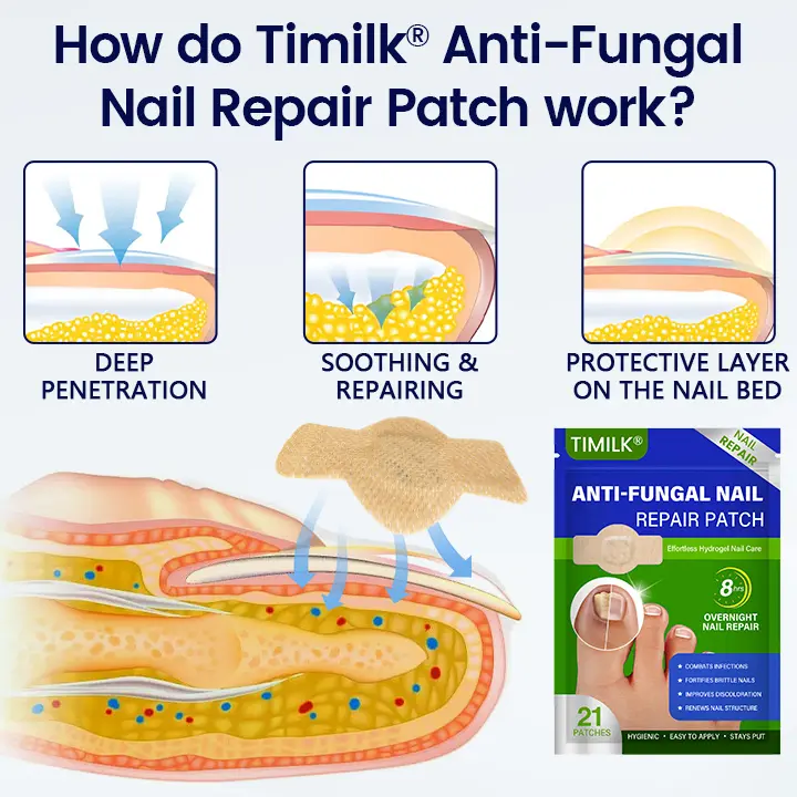 Anti-Fungal Nail Repair Patch - Image 4