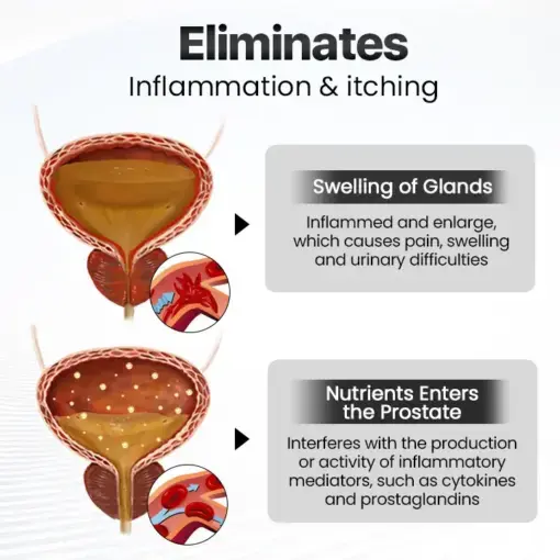 BeeBreathe Prostate Care Nasal Therapy Inhaler - Image 3