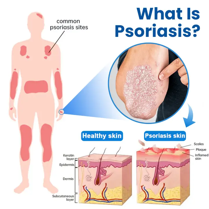 Magnesium Herbal Treatment Spray - Image 2