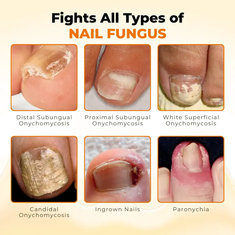 NailRevive Bee Venom Anti-fungi Solution - Image 3