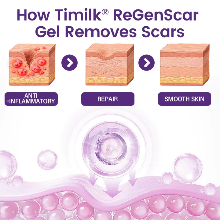 ReGenScar Stem Cell Scar Gel - Image 4