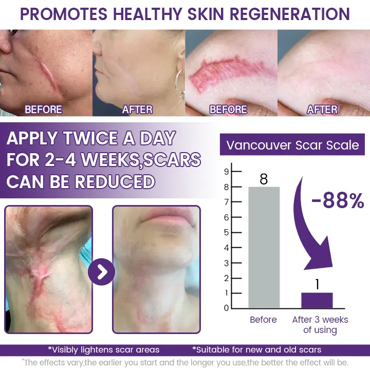 ReGenScar Stem Cell Scar Gel - Image 5