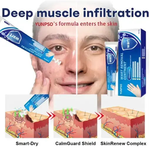 Mole and Wart Removal Cream - Image 4