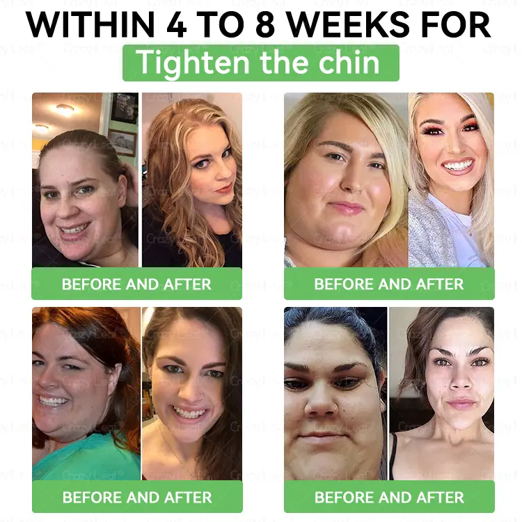 ๐๐ญ๐ช๐ฎ & ๐๐ช๐ต๐ข๐ญ๐ช๐ต๐บ ๐ฎ๐๐บ๐
๐olution - Image 5