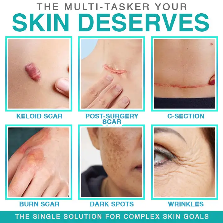 3-in-1 Microneedle Care Patch - Image 2