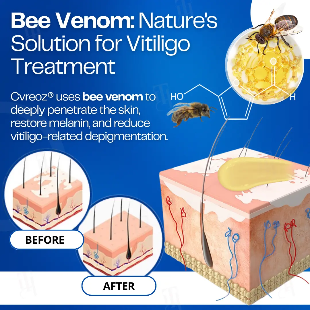 VitiClear Bee Venom Cream | No More Hiding that Skin! - Image 4