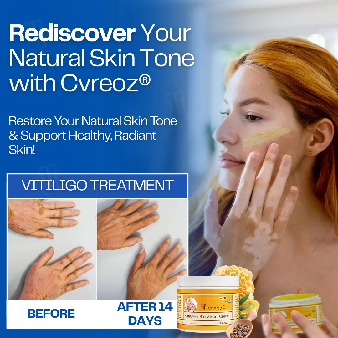 VitiClear Bee Venom Cream | No More Hiding that Skin! - Image 6