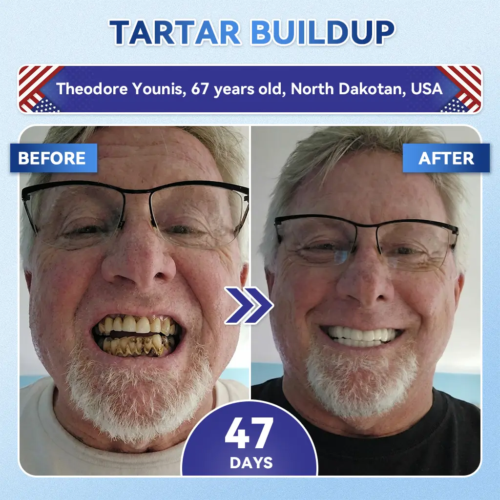 ๐๐ข๐๐๐ ๐ฅ๐ฎ๐ฌ๐ข๐ ๐๐จ๐จ๐ญ๐ก & ๐๐ฎ๐ฆ ๐๐๐ฉ๐๐ข๐ซ ๐๐ข๐๐ซ๐จ๐ง๐๐๐๐ฅ๐ ๐๐๐ญ๐๐ก - Image 2