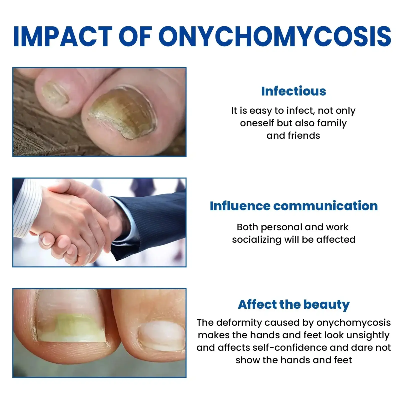 Fungus Nail Repair Patches - Image 2