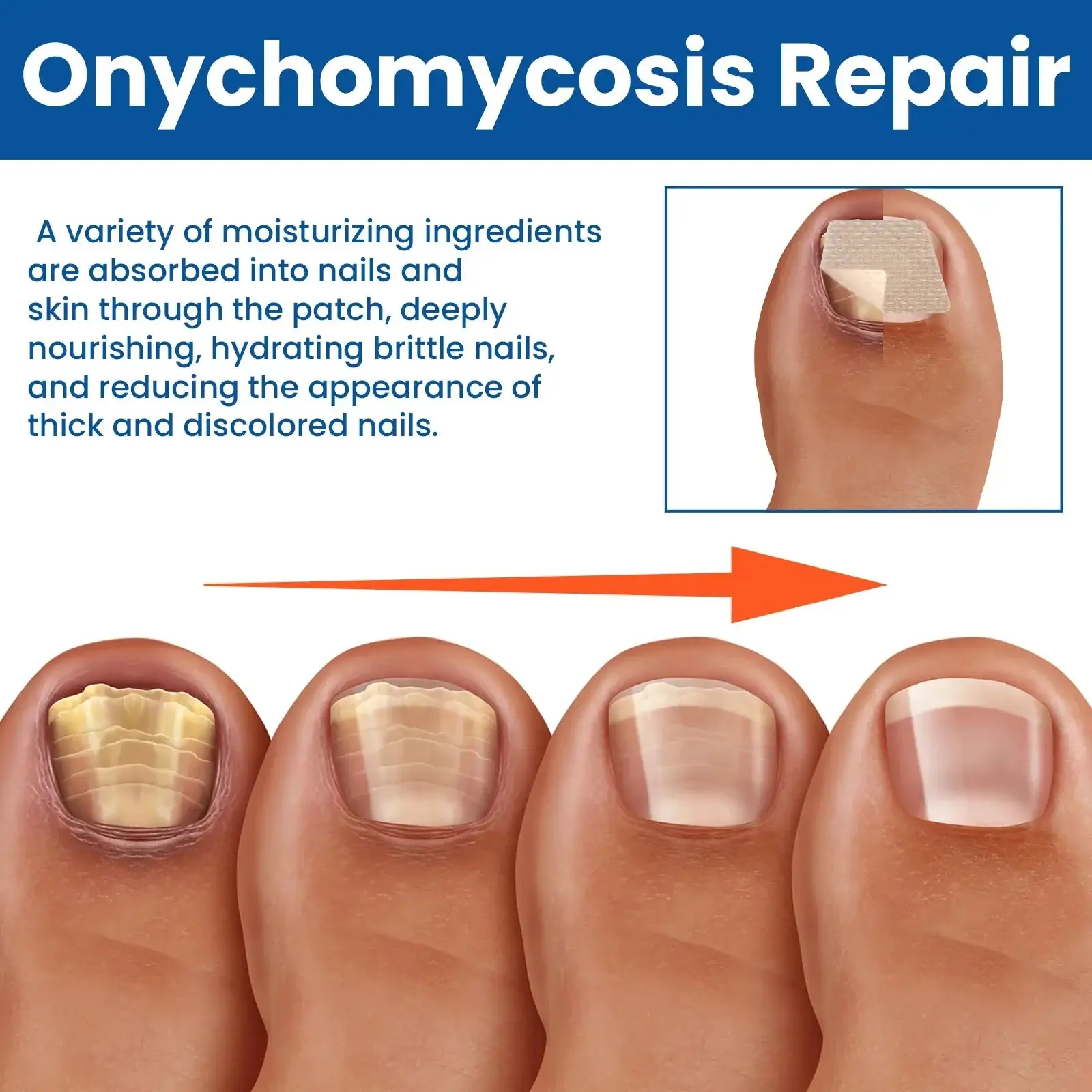 Fungus Nail Repair Patches - Image 4