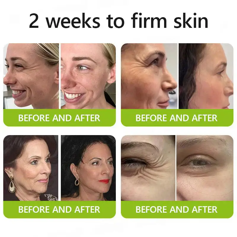 BOTOX & VITA A RETINOL SHOT Wrinkle Lift Tightening Cream - Image 14