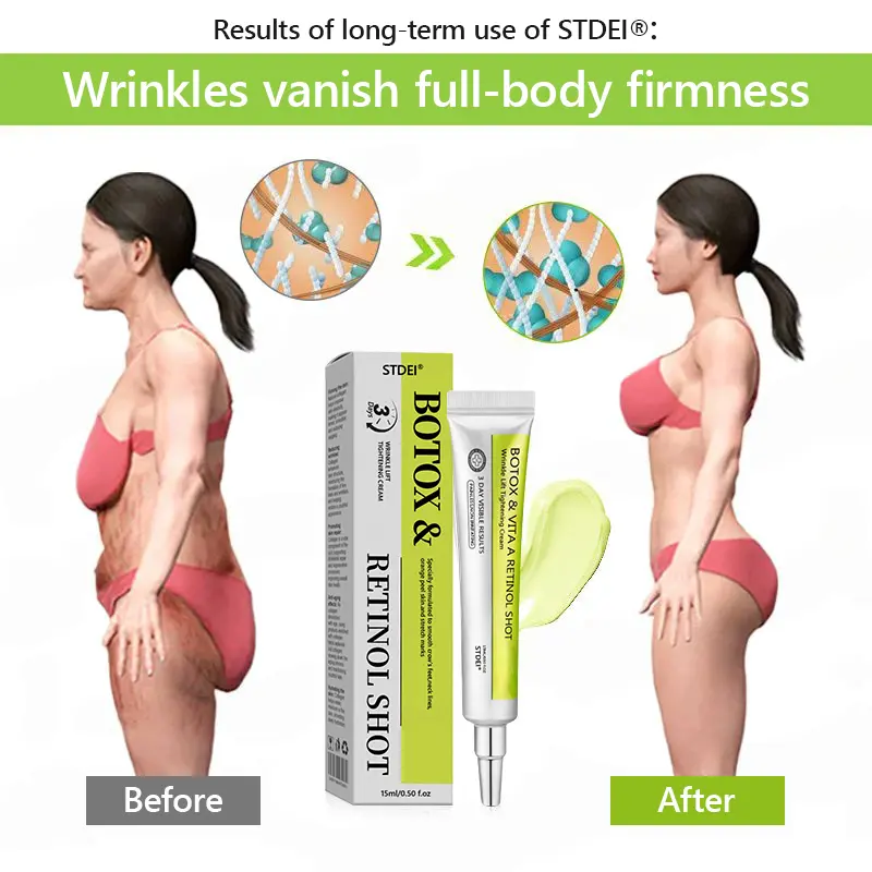 BOTOX & VITA A RETINOL SHOT Wrinkle Lift Tightening Cream - Image 56