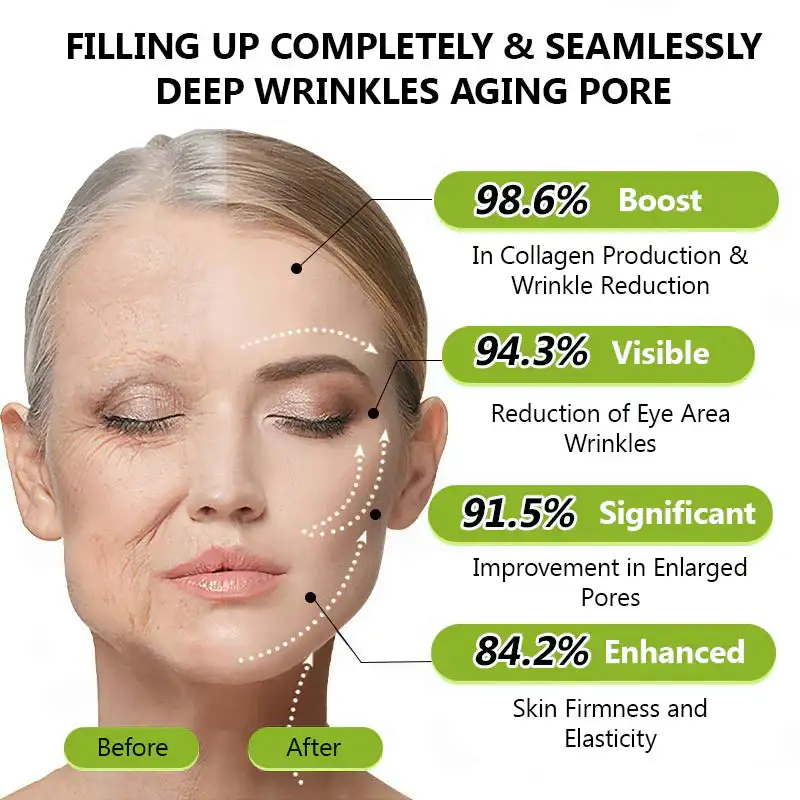 BOTOX & VITA A RETINOL SHOT Wrinkle Lift Tightening Cream - Image 8