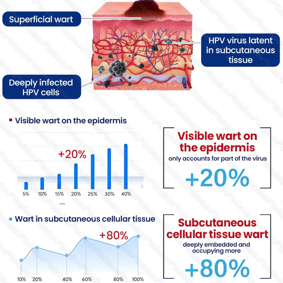 🔥Best WartLock Cryo-Recovery Cooling Spray🎉Special limited-time discount - Image 3