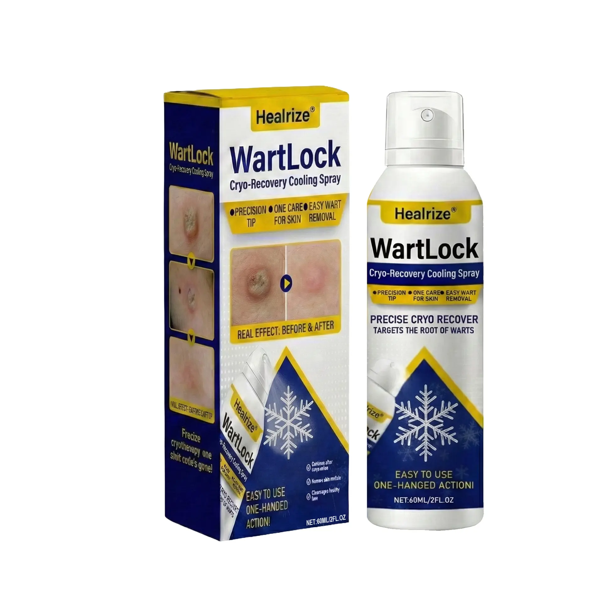 🔥Best WartLock Cryo-Recovery Cooling Spray🎉Special limited-time discount - Image 8