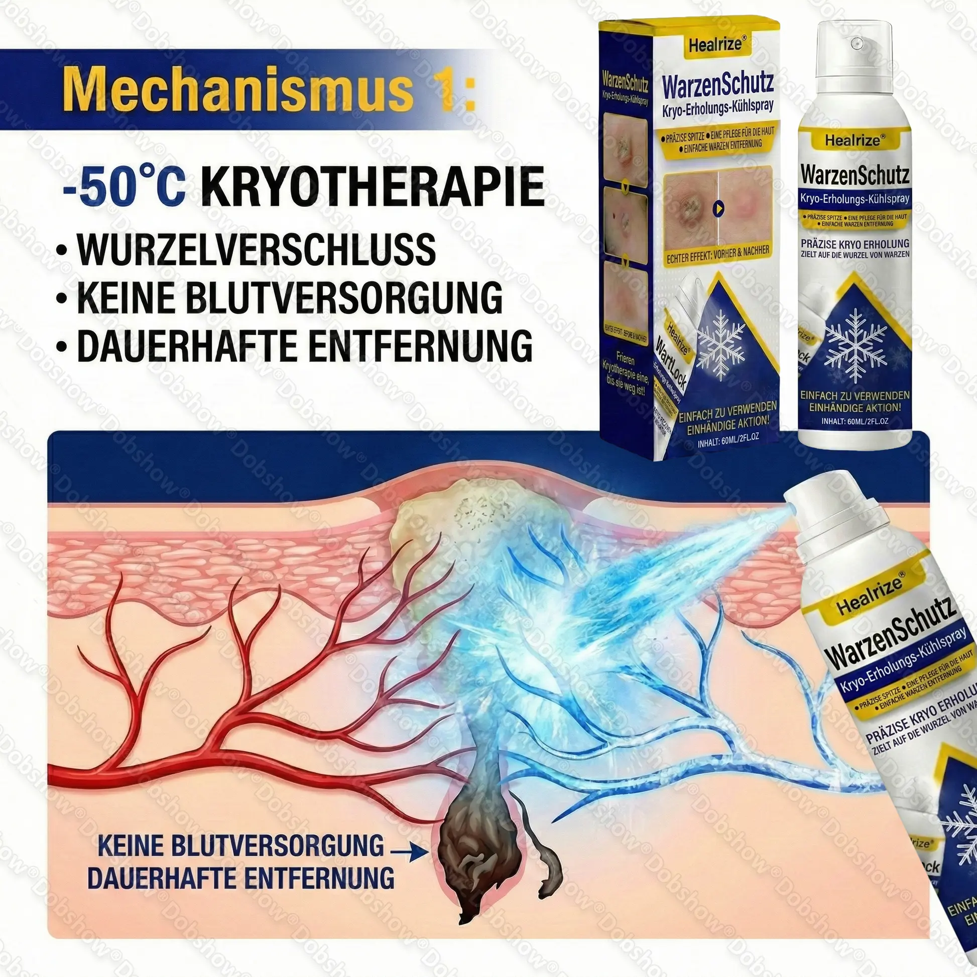 WartLock Kryo-Recovery Kühlspray🎉 Zeitlich begrenzter Sonderrabatt - Image 2