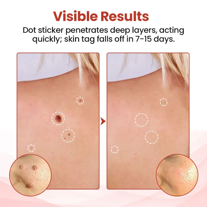 TagDrop Painless Micro Patch - Image 7