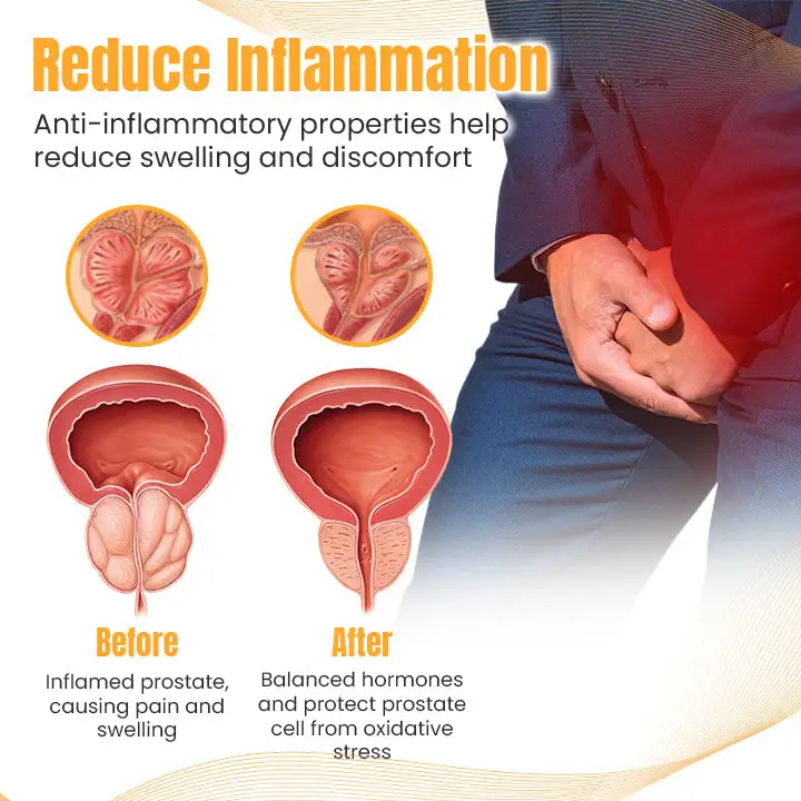 Prostalief Bee Venom Care Cream - Image 3