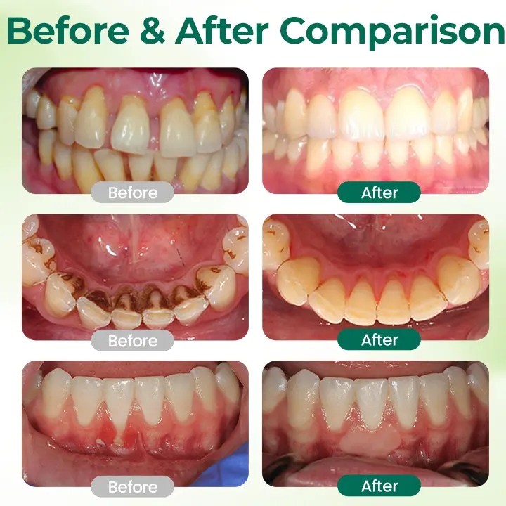 Zero-Waste Mouth Tabs - Image 3