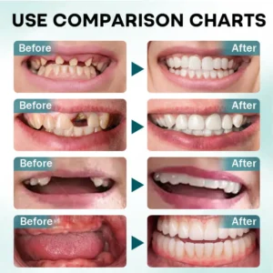 Alternative view of 𝐅𝐢𝐫𝐦𝐇𝐨𝐥𝐝 𝐃𝐞𝐧𝐭𝐮𝐫𝐞 𝐀𝐝𝐡𝐞𝐬𝐢𝐯𝐞