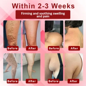 Alternative view of VenoLymph Massage Therapy Cream