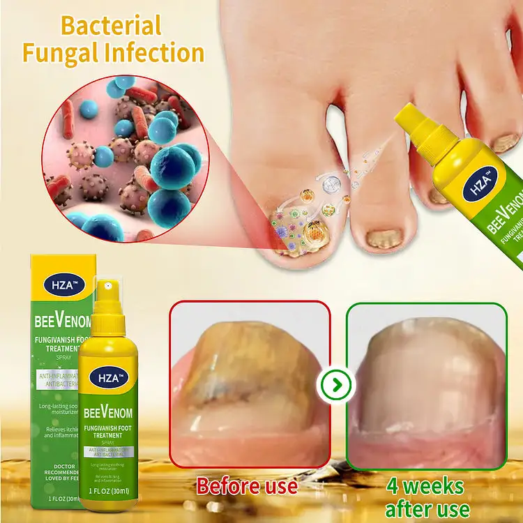 FungiVanish Foot Treatment Spray - Image 4