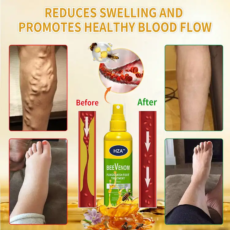 FungiVanish Foot Treatment Spray - Image 7