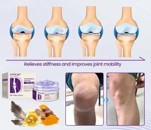 (🔥LAST DAY SALE – 80% OFF) Curcumin & Emu Oil Pain Gel – 🏥Backed by US Osteopathic Experts - Image 10