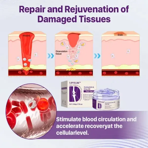 (🔥LAST DAY SALE – 80% OFF) Curcumin & Emu Oil Pain Gel – 🏥Backed by US Osteopathic Experts - Image 5