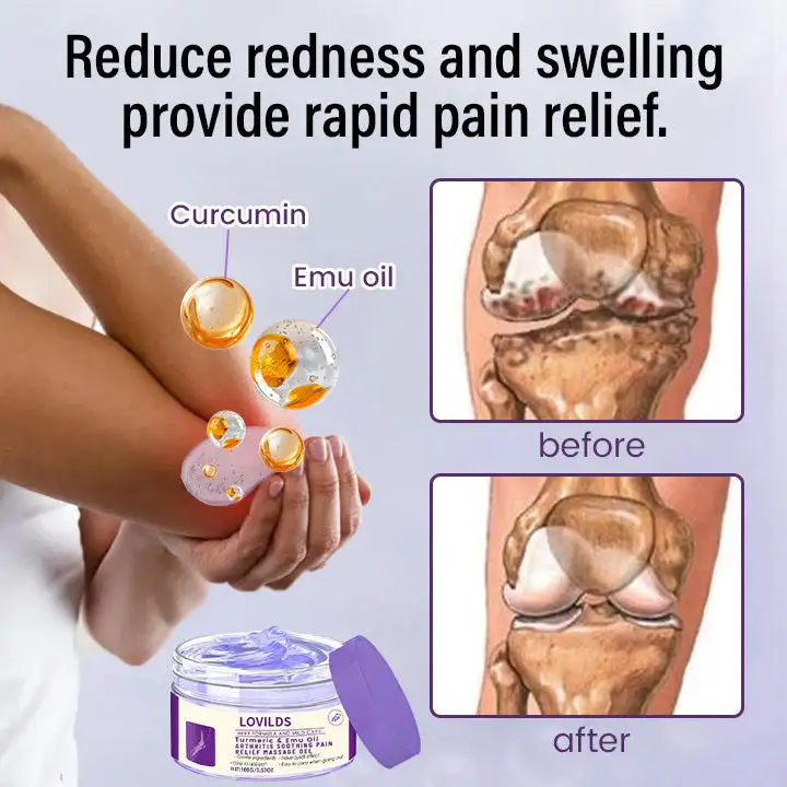 Arthritis Relief Gel: Turmeric & Emu Oil for Fast Soothing Relief - Image 3