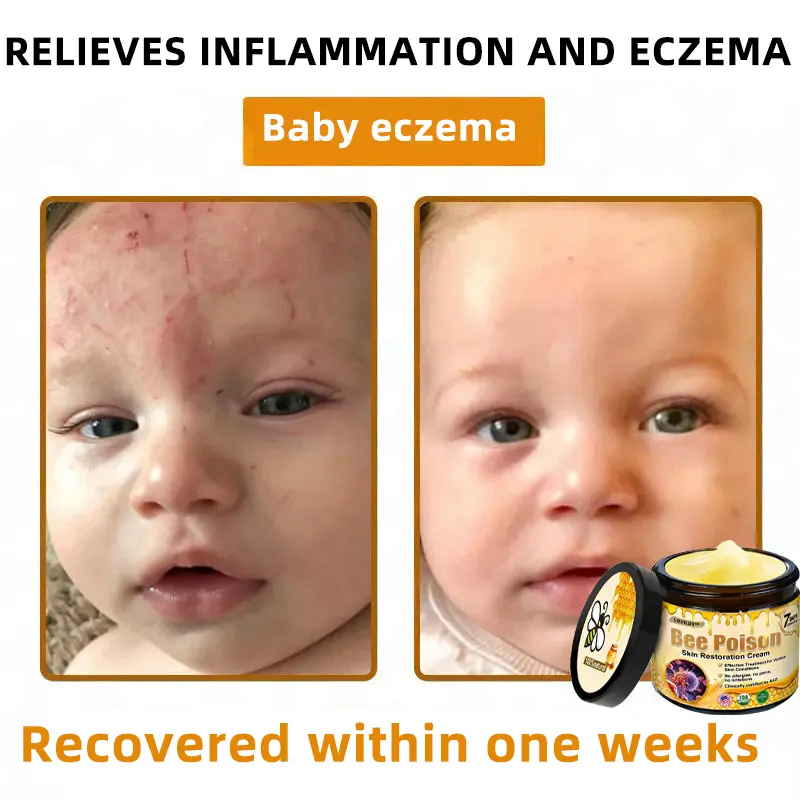 Bee Poison Skin Restoration Cream - Image 8