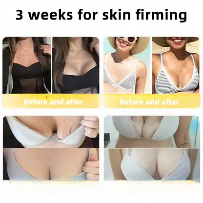 🐝Bee Poison Skin Restoration Cream 🐝 - Image 4