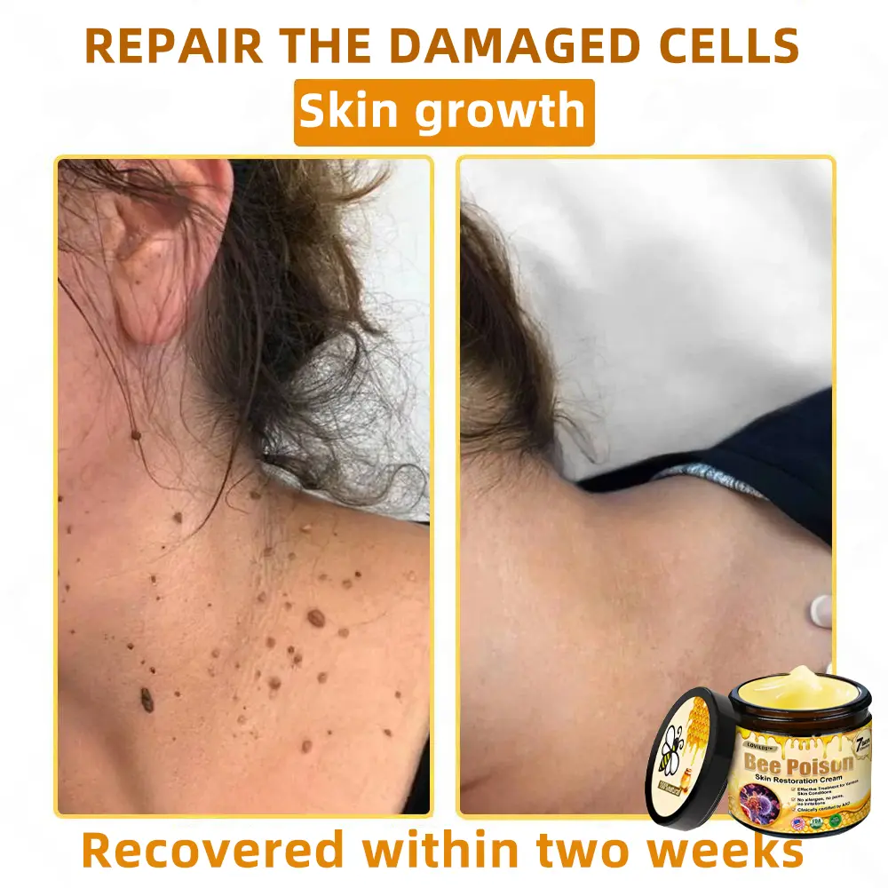 🐝Bee Poison Skin Restoration Cream 🐝 - Image 9