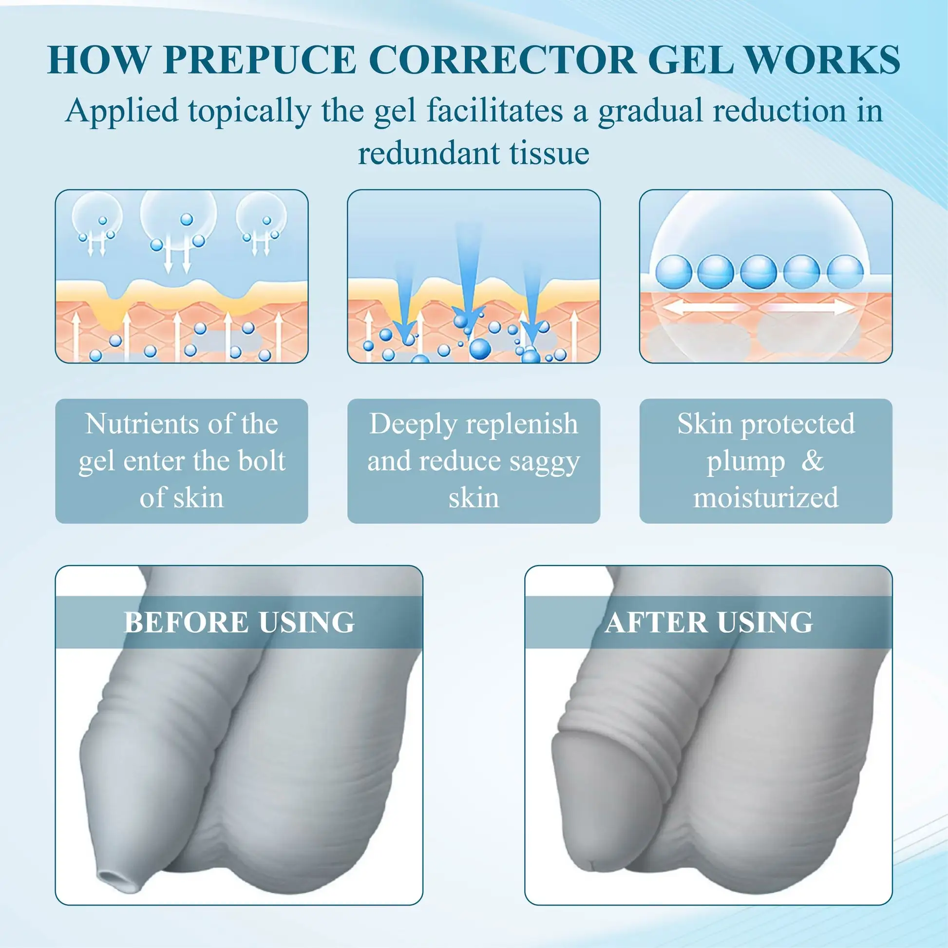 Redundant PrepuceCorrector Gel - Image 6