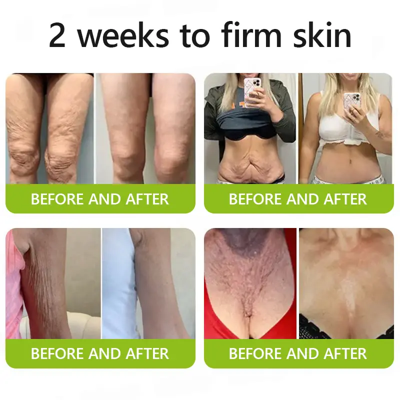 Botox & Retinol Shot - Image 5