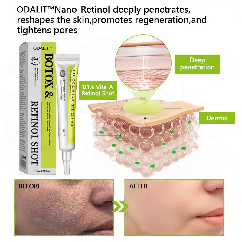 Botox & Retinol Shot - Image 6