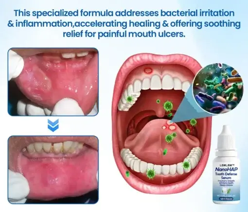 NanoHAP Tooth Defense Serum - Image 11