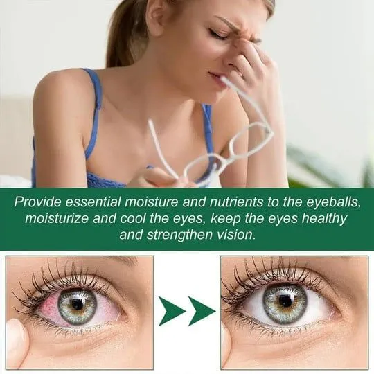 Presbyopia Eye Drops - Image 5