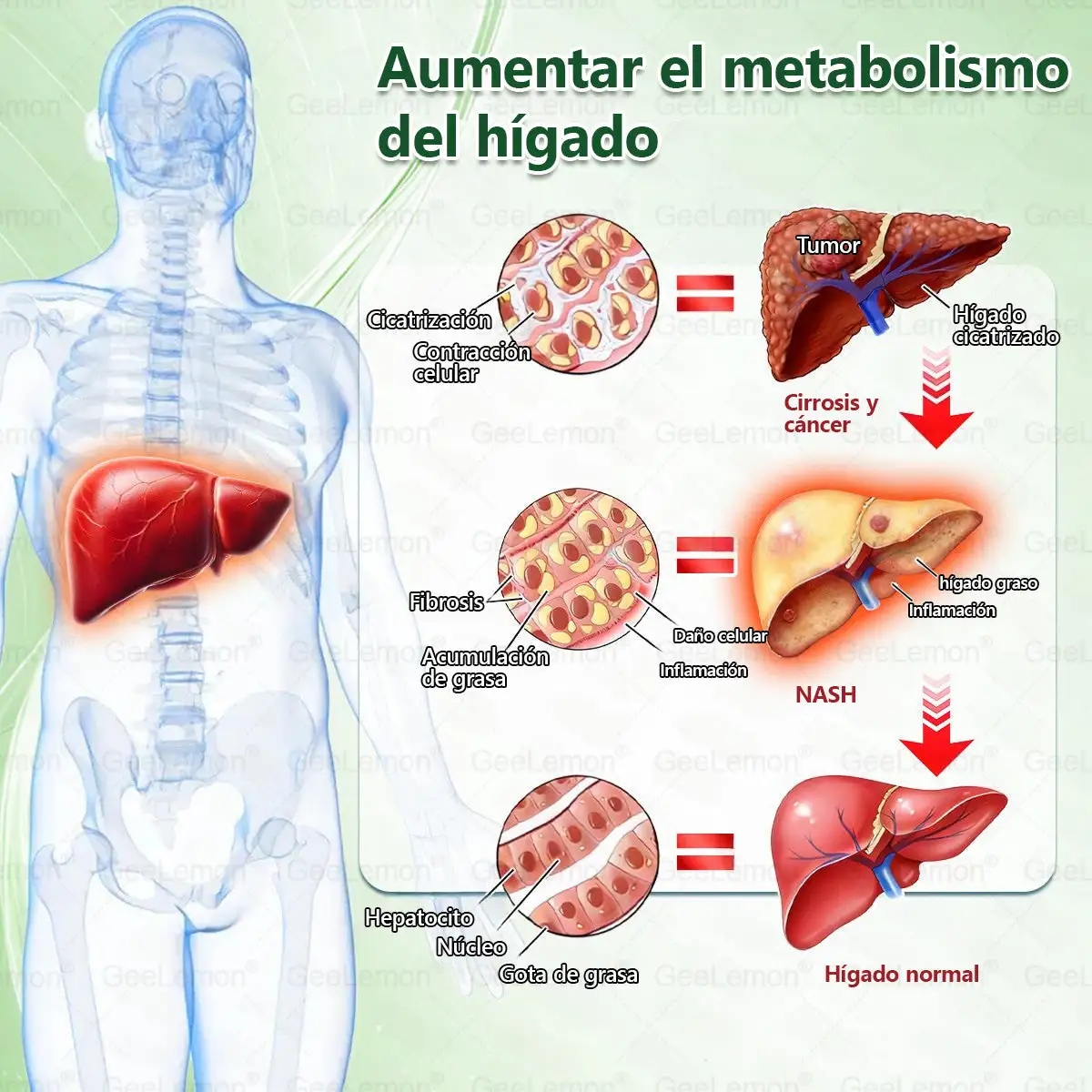 ๐๐จ๐ซ๐ข๐ง๐ ๐ ยท ๐๐๐ซ๐๐๐ซ๐ข๐ง๐ ร ๐๐๐+ ๐๐ ๐๐ง ๐ ๐๐๐ซ๐๐ก๐ ๐๐ฏ๐๐ง๐ณ๐๐๐จ ๐๐ ๐๐๐ง๐จ-๐๐ข๐๐ซ๐จ๐๐ ๐ฎ๐ฃ๐๐ฌ - Image 14