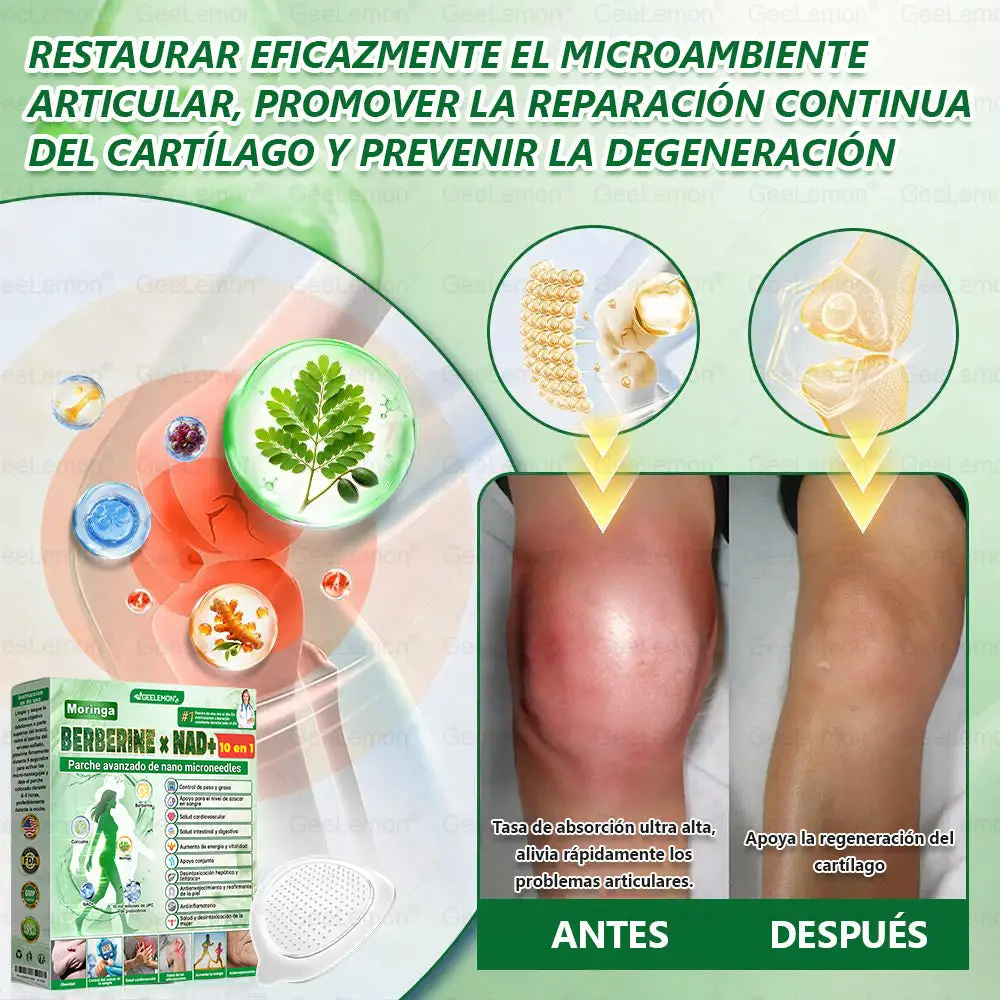 ๐๐จ๐ซ๐ข๐ง๐ ๐ ยท ๐๐๐ซ๐๐๐ซ๐ข๐ง๐ ร ๐๐๐+ ๐๐ ๐๐ง ๐ ๐๐๐ซ๐๐ก๐ ๐๐ฏ๐๐ง๐ณ๐๐๐จ ๐๐ ๐๐๐ง๐จ-๐๐ข๐๐ซ๐จ๐๐ ๐ฎ๐ฃ๐๐ฌ - Image 15