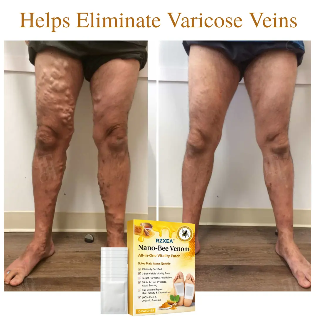 Nano-Bee Venom All-in-One Vitality Patch - Image 5