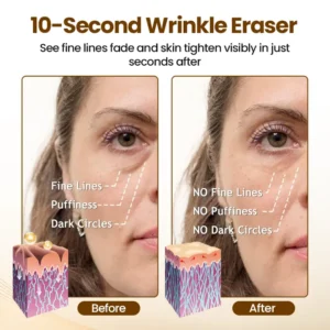 Alternative view of 10-Second Rapid Renewal Anti-Wrinkle Serum