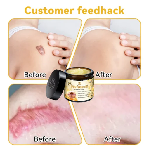 Aotearoa Bee Venom Skin Treatment Cream - Image 9
