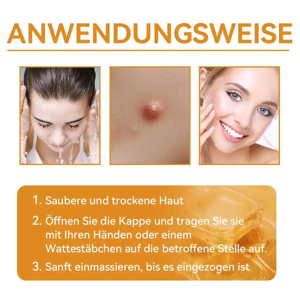 Bienengift Waren & Muttermalenfernung Creme - Image 14