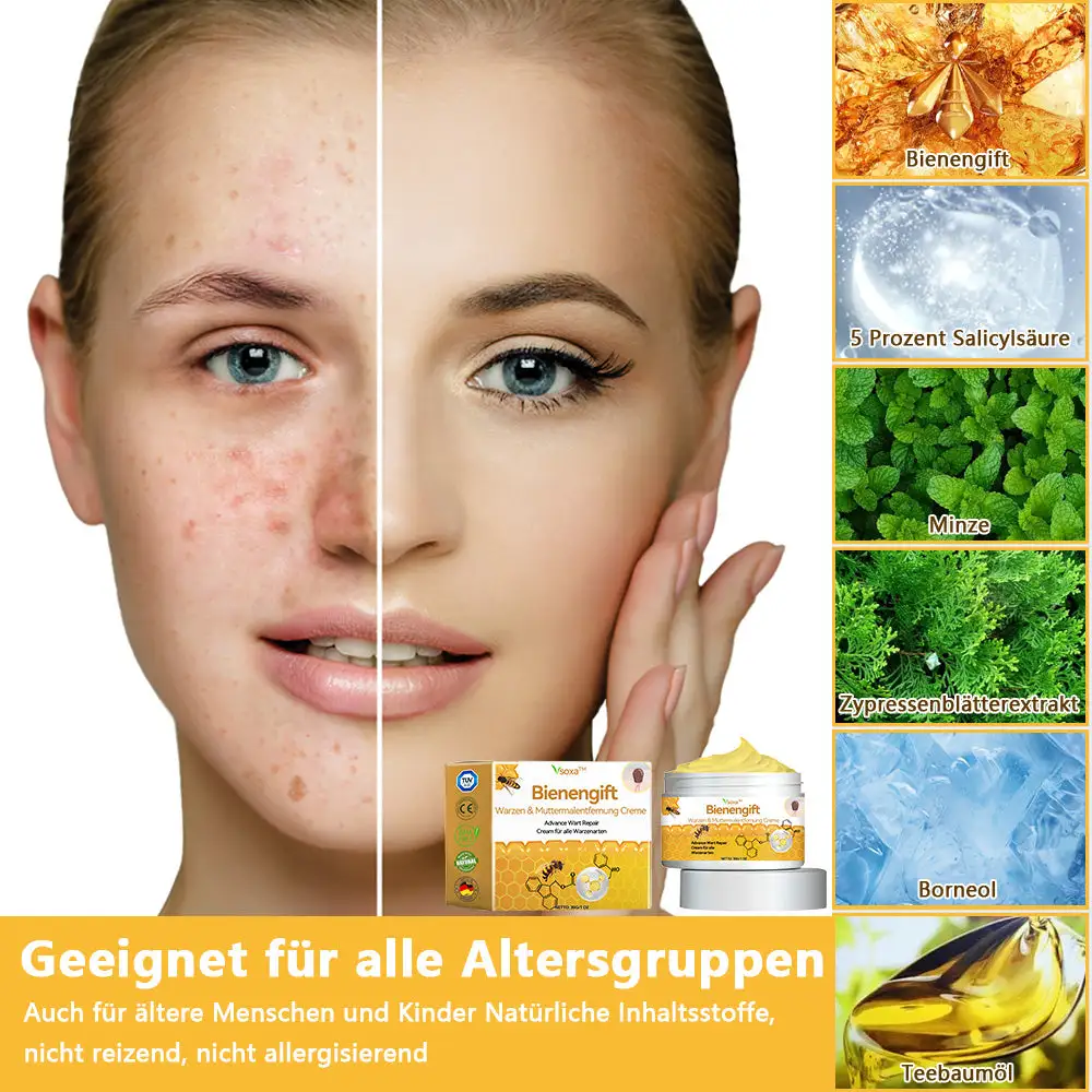 Bienengift Waren & Muttermalenfernung Creme - Image 2